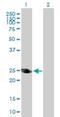 Alcohol Dehydrogenase 6 (Class V) antibody, H00000130-D01P, Novus Biologicals, Western Blot image 