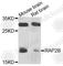 RAP2B, Member Of RAS Oncogene Family antibody, A4071, ABclonal Technology, Western Blot image 