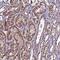 DIS3 Like Exosome 3'-5' Exoribonuclease antibody, NBP1-81941, Novus Biologicals, Immunohistochemistry paraffin image 