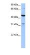 Putative protein TPRXL antibody, NBP1-91423, Novus Biologicals, Western Blot image 