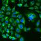 Recoverin antibody, FNab07225, FineTest, Immunofluorescence image 