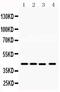 MHC Class I Polypeptide-Related Sequence A antibody, PA5-79671, Invitrogen Antibodies, Western Blot image 