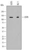 Ubiquitin carboxyl-terminal hydrolase 8 antibody, AF7735, R&D Systems, Western Blot image 