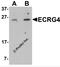 Augurin antibody, 6535, ProSci, Western Blot image 