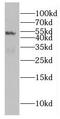 Eukaryotic initiation factor 4A-III antibody, FNab02718, FineTest, Western Blot image 
