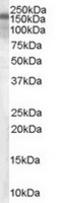 TSC Complex Subunit 1 antibody, TA302506, Origene, Western Blot image 