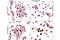 p53 antibody, 2676T, Cell Signaling Technology, Immunohistochemistry paraffin image 