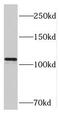 Retinoic Acid Induced 14 antibody, FNab07091, FineTest, Western Blot image 
