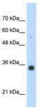 Homeobox protein Hox-B4 antibody, TA345377, Origene, Western Blot image 