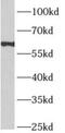 Aprataxin And PNKP Like Factor antibody, FNab00484, FineTest, Western Blot image 