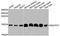 NADH:Ubiquinone Oxidoreductase Subunit A7 antibody, A8441, ABclonal Technology, Western Blot image 