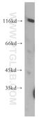 Phosphodiesterase 6A antibody, 21200-1-AP, Proteintech Group, Western Blot image 
