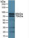 Integrin Subunit Beta 2 antibody, LS-C372779, Lifespan Biosciences, Western Blot image 