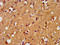 BAI1-associated protein 3 antibody, LS-C670786, Lifespan Biosciences, Immunohistochemistry paraffin image 