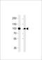 Villin 1 antibody, LS-C160527, Lifespan Biosciences, Western Blot image 