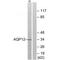 Aquaporin 12A antibody, A19520, Boster Biological Technology, Western Blot image 