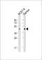 Branched Chain Amino Acid Transaminase 1 antibody, 55-059, ProSci, Western Blot image 