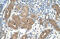 Acid Phosphatase antibody, ARP42178_T100, Aviva Systems Biology, Immunohistochemistry paraffin image 