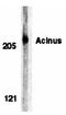 Apoptotic Chromatin Condensation Inducer 1 antibody, orb74402, Biorbyt, Western Blot image 
