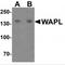 WAPL Cohesin Release Factor antibody, TA349056, Origene, Western Blot image 