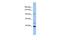 Leucine Rich Repeat Containing 37B antibody, PA5-43520, Invitrogen Antibodies, Western Blot image 