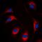 BMX Non-Receptor Tyrosine Kinase antibody, orb393226, Biorbyt, Immunofluorescence image 