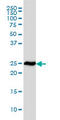 Ribosomal Protein L19 antibody, LS-C104903, Lifespan Biosciences, Western Blot image 