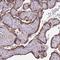 Zinc Finger Protein 746 antibody, NBP2-13594, Novus Biologicals, Immunohistochemistry frozen image 