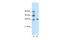 Zinc Finger Protein 124 antibody, 28-845, ProSci, Western Blot image 