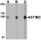 Stromal Interaction Molecule 2 antibody, orb74831, Biorbyt, Western Blot image 