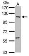 2'-5'-Oligoadenylate Synthetase 3 antibody, PA5-31090, Invitrogen Antibodies, Western Blot image 