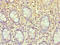 Endothelin-converting enzyme 2 antibody, LS-C375628, Lifespan Biosciences, Immunohistochemistry paraffin image 