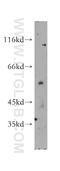 Stromal membrane-associated protein 1 antibody, 12799-1-AP, Proteintech Group, Western Blot image 
