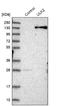 Unc-51 Like Autophagy Activating Kinase 2 antibody, NBP1-88881, Novus Biologicals, Western Blot image 