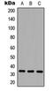 CD20 antibody, LS-C356204, Lifespan Biosciences, Western Blot image 