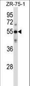 Complement C9 antibody, LS-C168207, Lifespan Biosciences, Western Blot image 