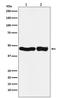 Ubiquinol-Cytochrome C Reductase Core Protein 2 antibody, M07937, Boster Biological Technology, Western Blot image 