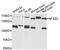 NFASC antibody, A3053, ABclonal Technology, Western Blot image 