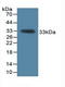 p68 antibody, LS-C728562, Lifespan Biosciences, Western Blot image 