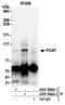 Lysine Acetyltransferase 2B antibody, A301-666A, Bethyl Labs, Immunoprecipitation image 