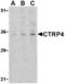 C1q And TNF Related 4 antibody, TA306234, Origene, Western Blot image 