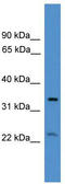Cytochrome C Oxidase Assembly Factor COX18 antibody, TA331420, Origene, Western Blot image 