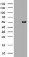 Amylase Alpha 2B (Pancreatic) antibody, M09355, Boster Biological Technology, Western Blot image 