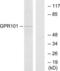 C-X-C Motif Chemokine Receptor 5 antibody, LS-B6713, Lifespan Biosciences, Western Blot image 