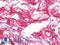 Lumican antibody, LS-B10541, Lifespan Biosciences, Immunohistochemistry paraffin image 