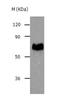 ATP Binding Cassette Subfamily G Member 2 (Junior Blood Group) antibody, TA322704, Origene, Western Blot image 