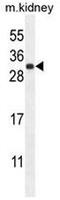 FGF-9 antibody, AP51661PU-N, Origene, Western Blot image 