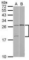 YY1 Associated Factor 2 antibody, PA5-30359, Invitrogen Antibodies, Western Blot image 
