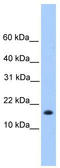 Centromere Protein W antibody, TA334935, Origene, Western Blot image 