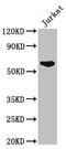 UDP-N-Acetylglucosamine Pyrophosphorylase 1 antibody, CSB-PA618067LA01HU, Cusabio, Western Blot image 